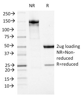 ATRX/RAD54 (Alpha Thalassemia Mental Retardation) Antibody in SDS-PAGE (SDS-PAGE)