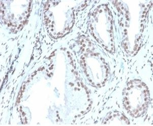 ATRX/RAD54 (Alpha Thalassemia Mental Retardation) Antibody in Immunohistochemistry (Paraffin) (IHC (P))