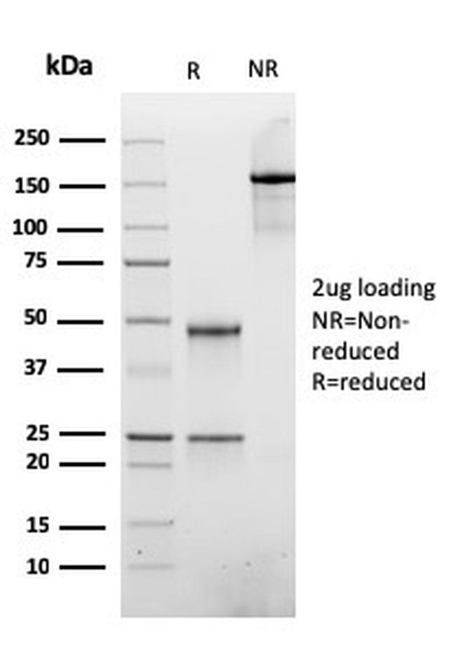 ATRX/RAD54 (Alpha Thalassemia Mental Retardation) Antibody in SDS-PAGE (SDS-PAGE)