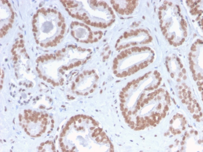 ATRX/RAD54 (Alpha Thalassemia Mental Retardation) Antibody in Immunohistochemistry (Paraffin) (IHC (P))