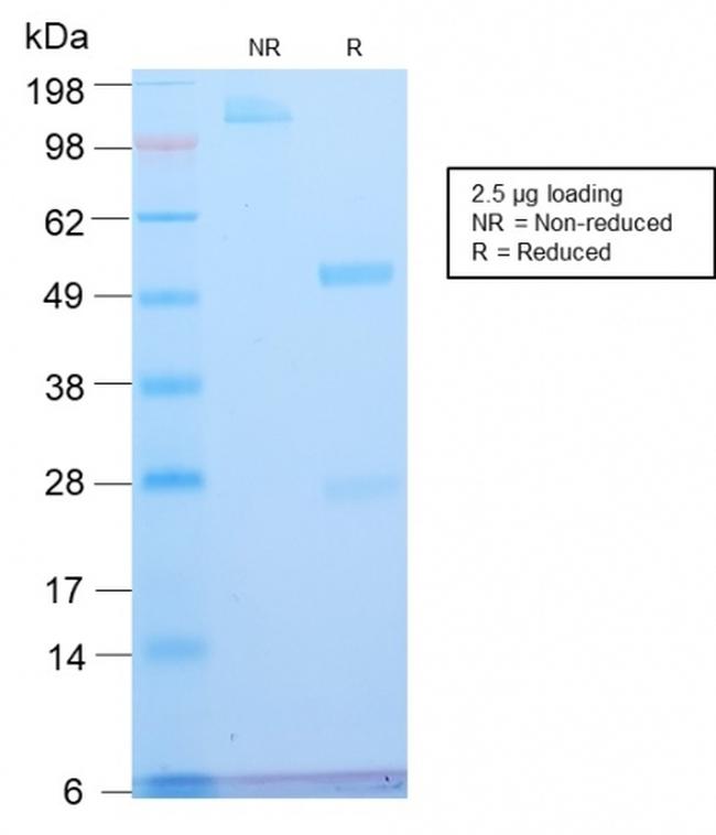 ATRX/RAD54 (Alpha Thalassemia Mental Retardation) Antibody in SDS-PAGE (SDS-PAGE)