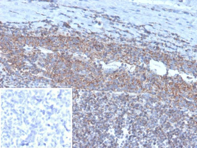 BCOR Antibody in Immunohistochemistry (Paraffin) (IHC (P))