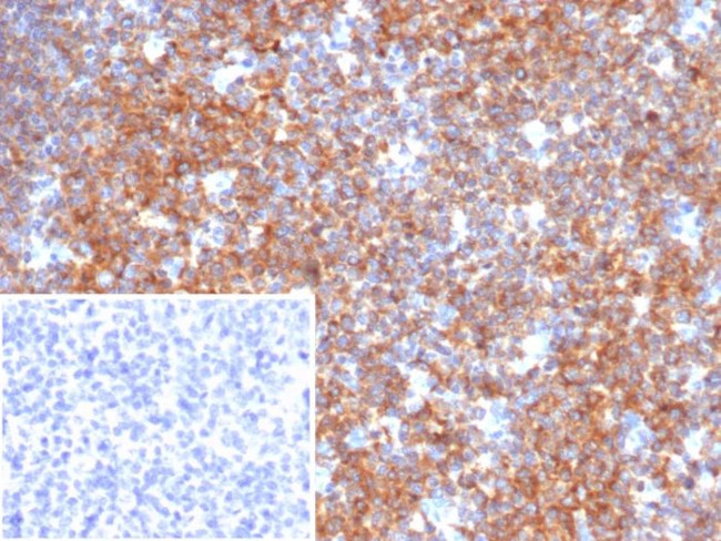 BCOR Antibody in Immunohistochemistry (Paraffin) (IHC (P))