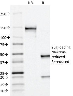 Prostate Specific Acid Phosphatase (PSAP) Antibody in SDS-PAGE (SDS-PAGE)