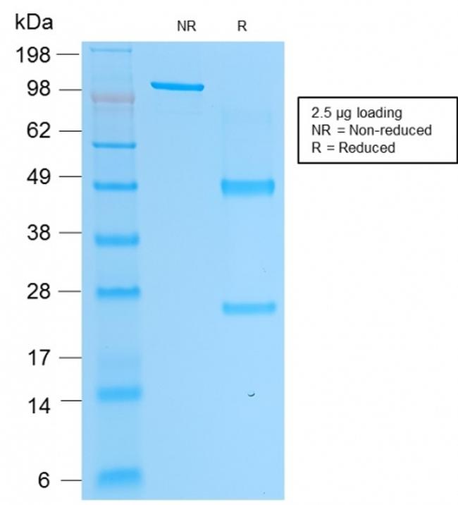 Prostate Specific Acid Phosphatase (PSAP) Antibody in SDS-PAGE (SDS-PAGE)