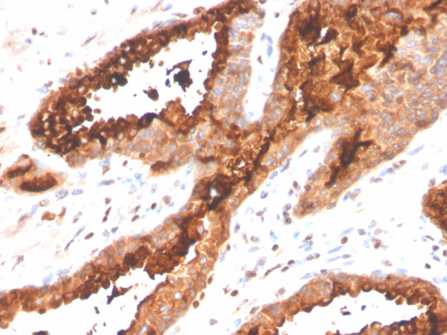 Prostate Specific Acid Phosphatase (PSAP) Antibody in Immunohistochemistry (Paraffin) (IHC (P))