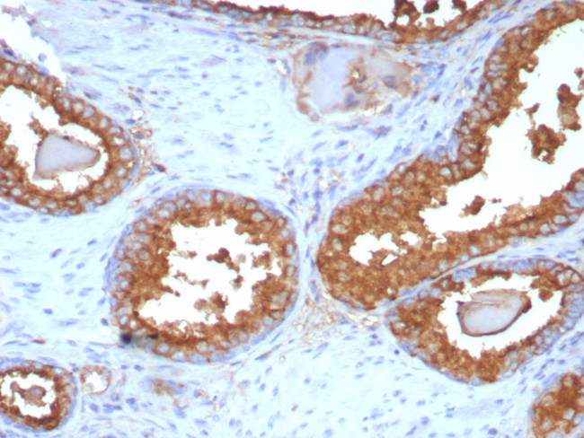 Prostate Specific Acid Phosphatase (PSAP) Antibody in Immunohistochemistry (Paraffin) (IHC (P))