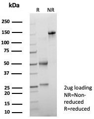 Prostate Specific Acid Phosphatase (PSAP) Antibody in SDS-PAGE (SDS-PAGE)