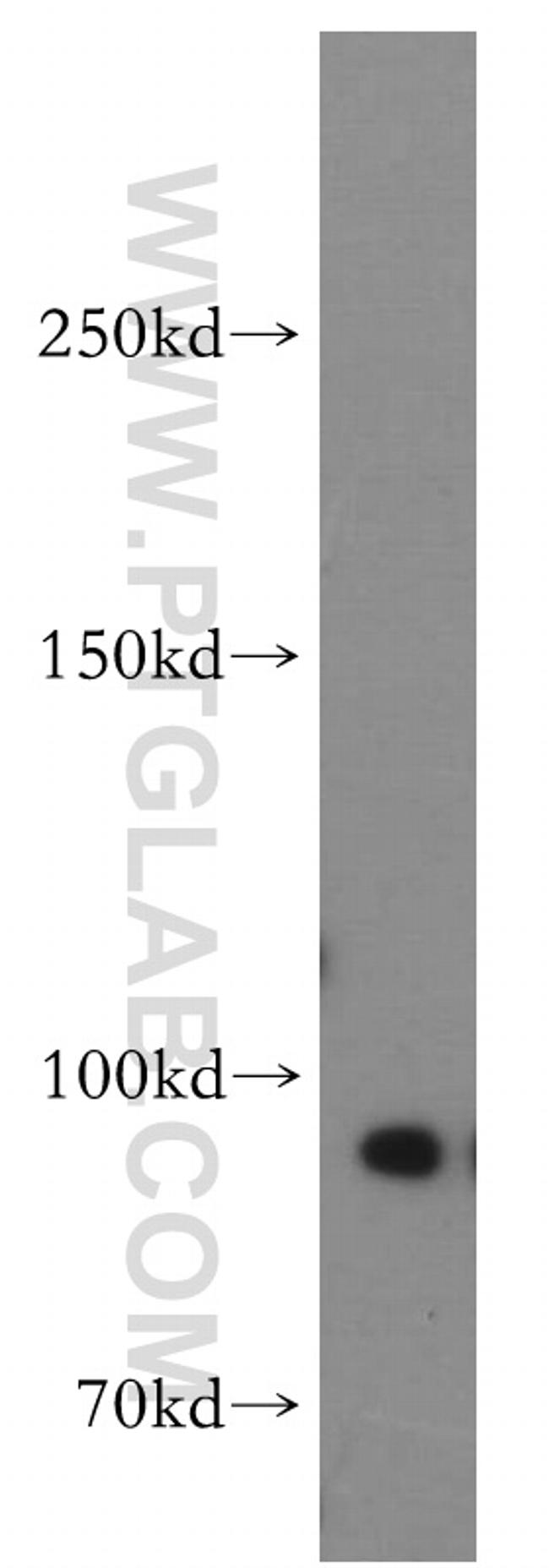 Drosha Antibody in Western Blot (WB)