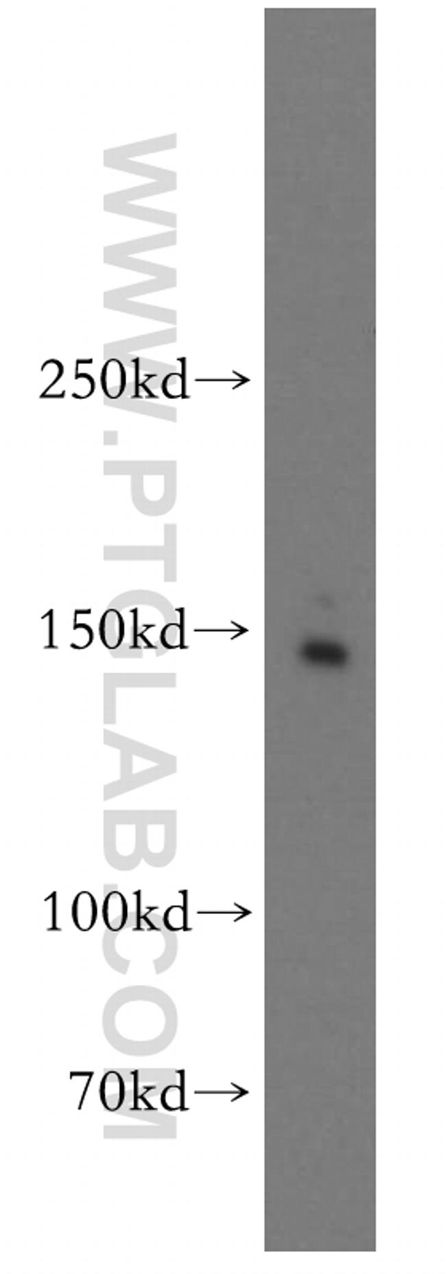 Drosha Antibody in Western Blot (WB)