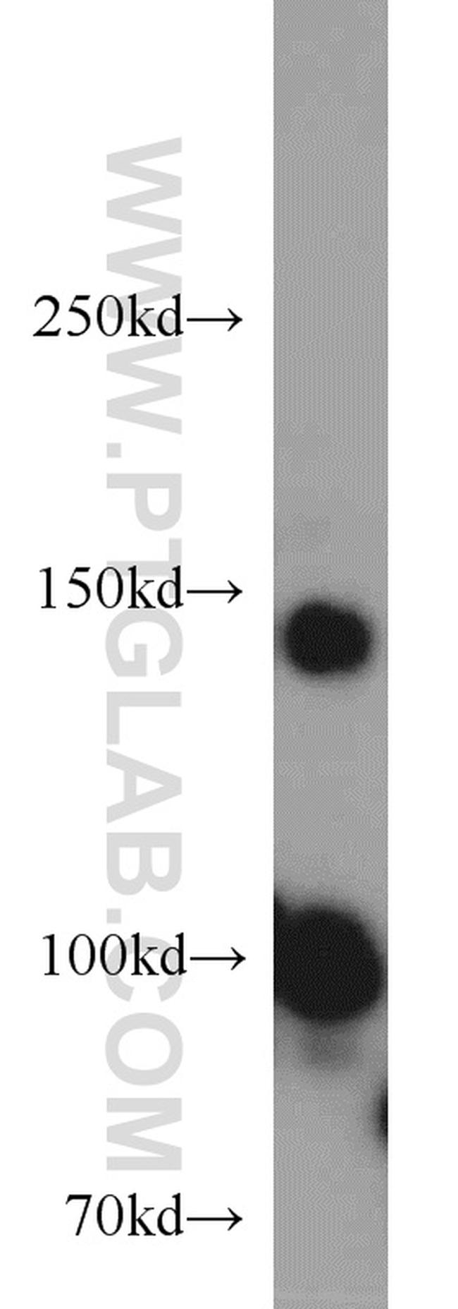 Drosha Antibody in Western Blot (WB)