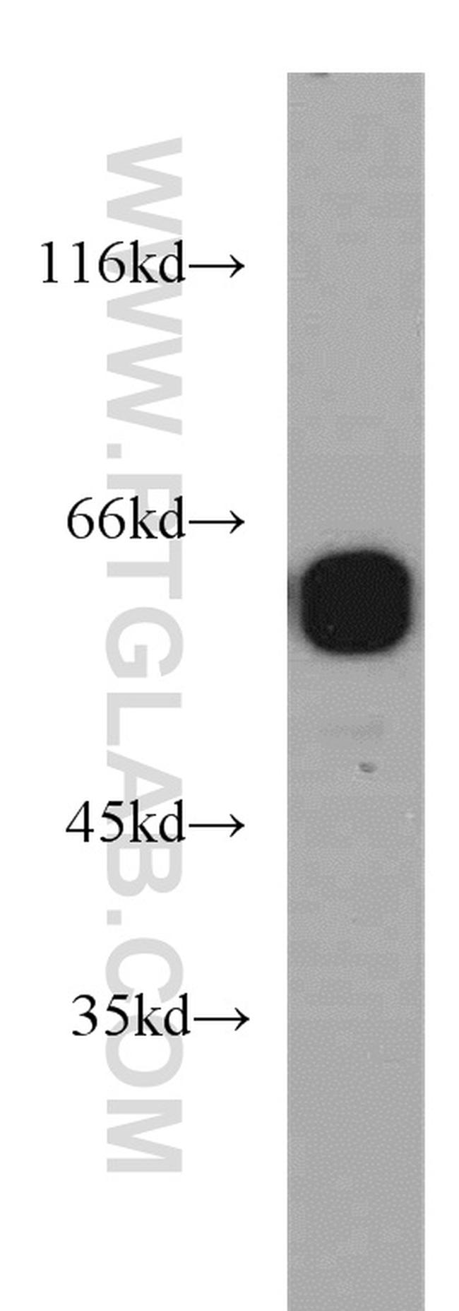 NOVA2 Antibody in Western Blot (WB)