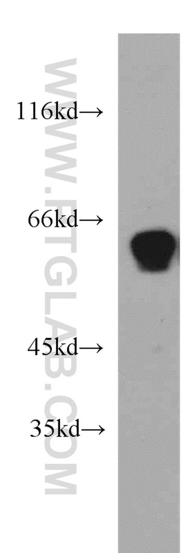 NOVA2 Antibody in Western Blot (WB)