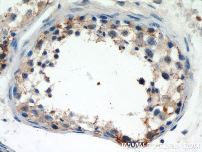 LIN41 Antibody in Immunohistochemistry (Paraffin) (IHC (P))