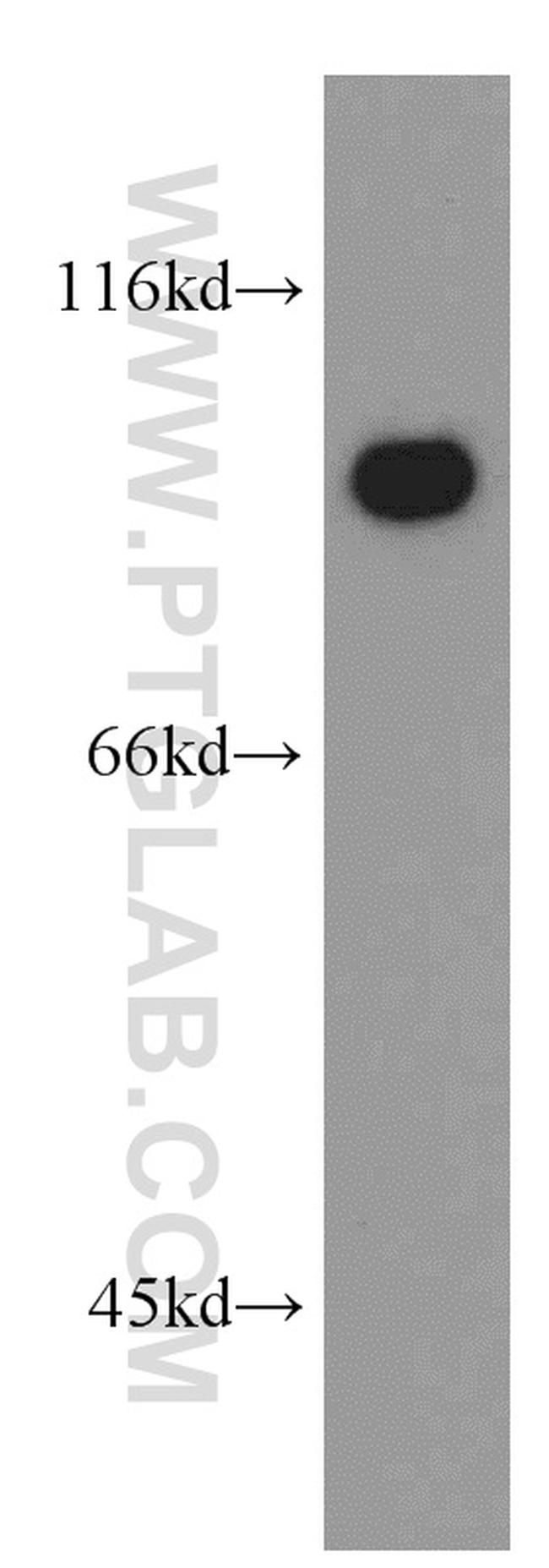 LIN41 Antibody in Western Blot (WB)