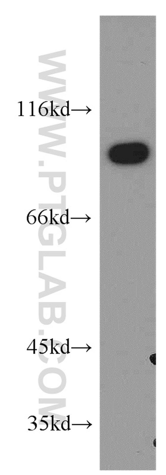 LIN41 Antibody in Western Blot (WB)