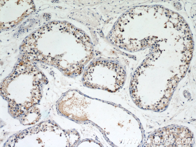 LIN41 Antibody in Immunohistochemistry (Paraffin) (IHC (P))