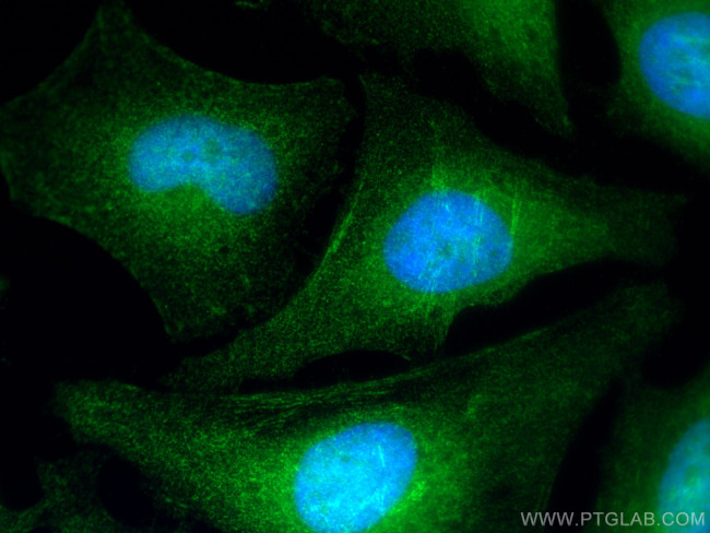 Cyclin B1 Antibody in Immunocytochemistry (ICC/IF)