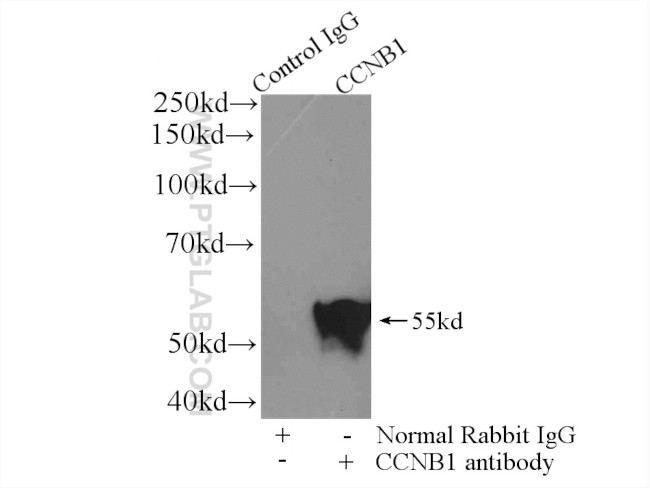 Cyclin B1 Antibody in Immunoprecipitation (IP)