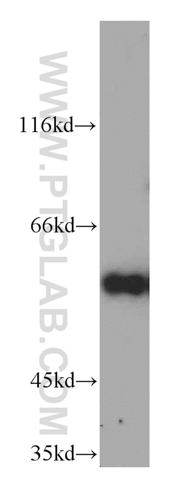 Cyclin B1 Antibody in Western Blot (WB)