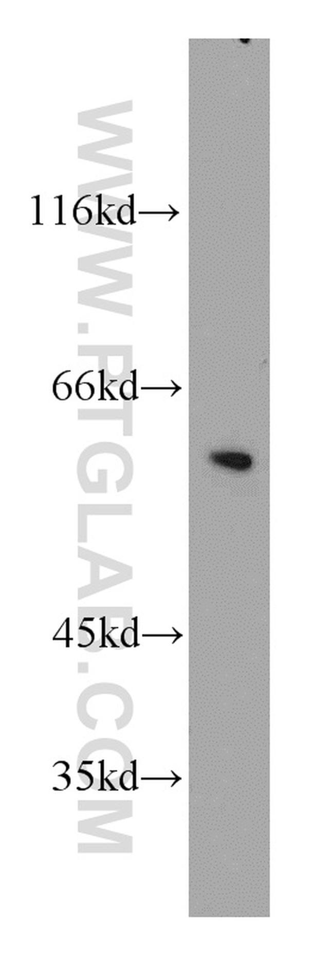 Cyclin B1 Antibody in Western Blot (WB)