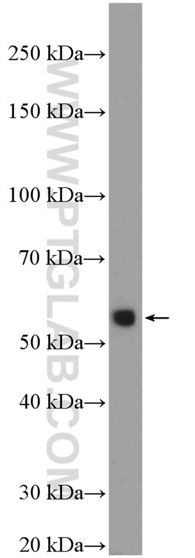 Cyclin B1 Antibody in Western Blot (WB)