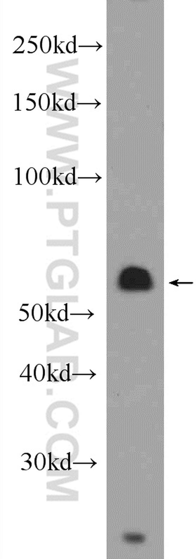 Cyclin B1 Antibody in Western Blot (WB)