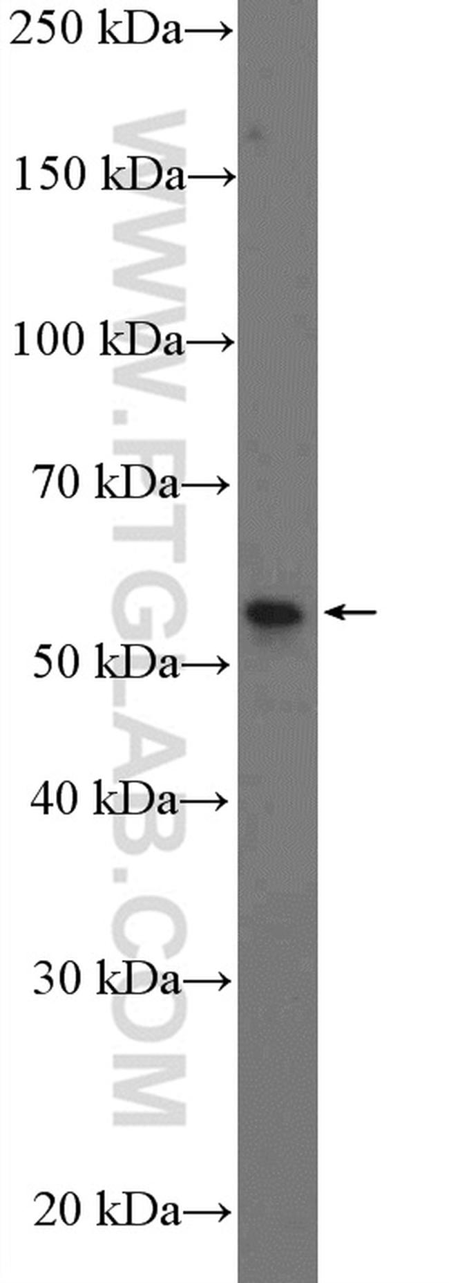 Cyclin B1 Antibody in Western Blot (WB)