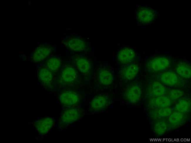 SETD1B Antibody in Immunocytochemistry (ICC/IF)