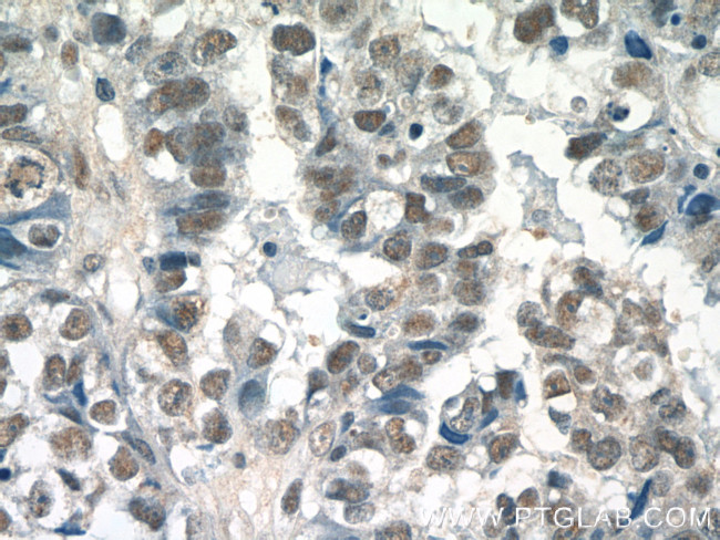 SETD1B Antibody in Immunohistochemistry (Paraffin) (IHC (P))