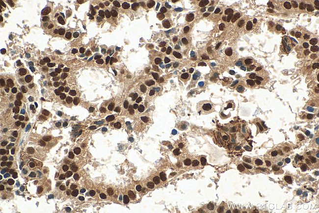 SETD1B Antibody in Immunohistochemistry (Paraffin) (IHC (P))