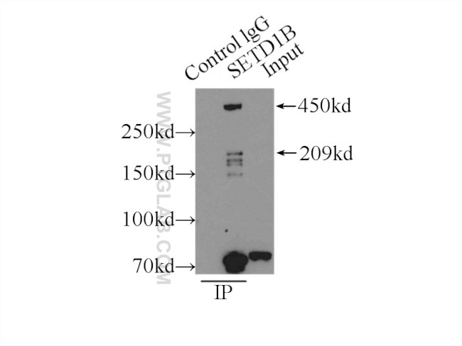 SETD1B Antibody in Immunoprecipitation (IP)