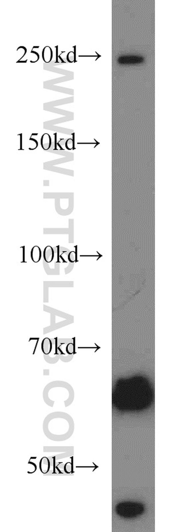 SETD1B Antibody in Western Blot (WB)