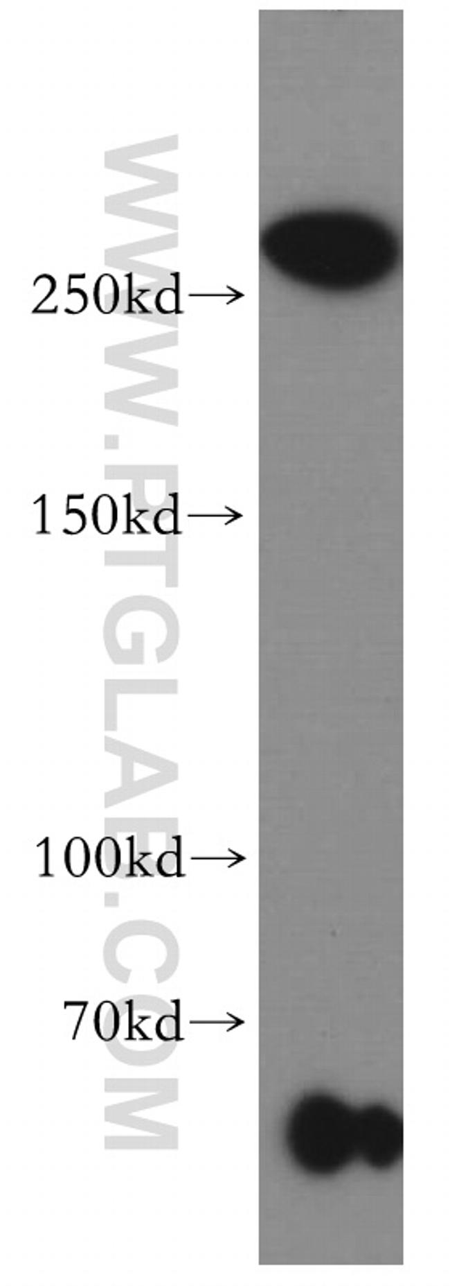 SETD1B Antibody in Western Blot (WB)