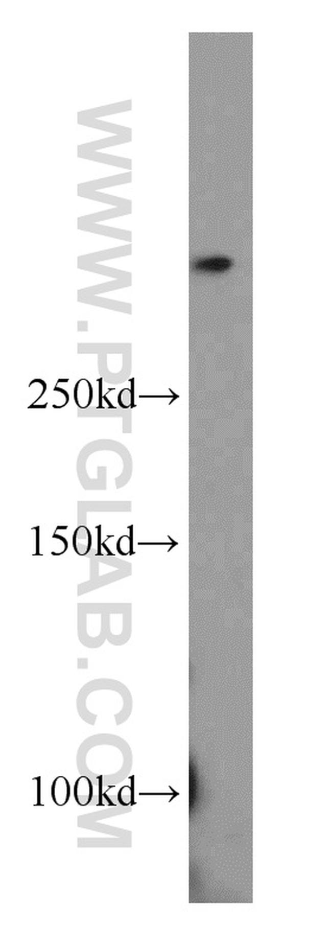 SETD1B Antibody in Western Blot (WB)