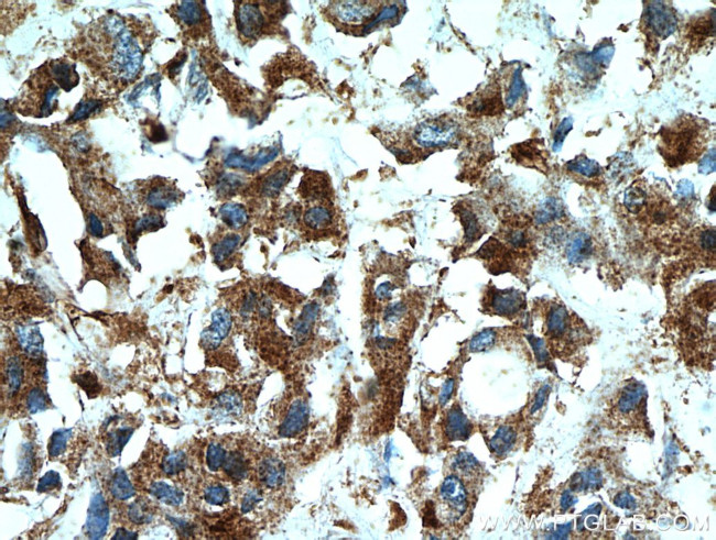 WDFY3 Antibody in Immunohistochemistry (Paraffin) (IHC (P))