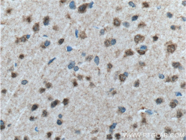 WDFY3 Antibody in Immunohistochemistry (Paraffin) (IHC (P))