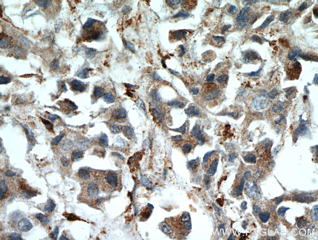 WDFY3 Antibody in Immunohistochemistry (Paraffin) (IHC (P))