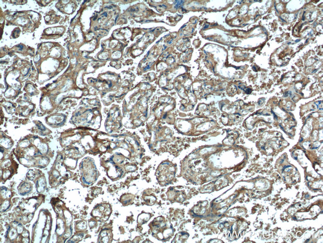 HTRA1 Antibody in Immunohistochemistry (Paraffin) (IHC (P))