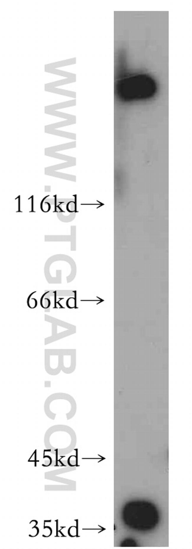 HTRA1 Antibody in Western Blot (WB)