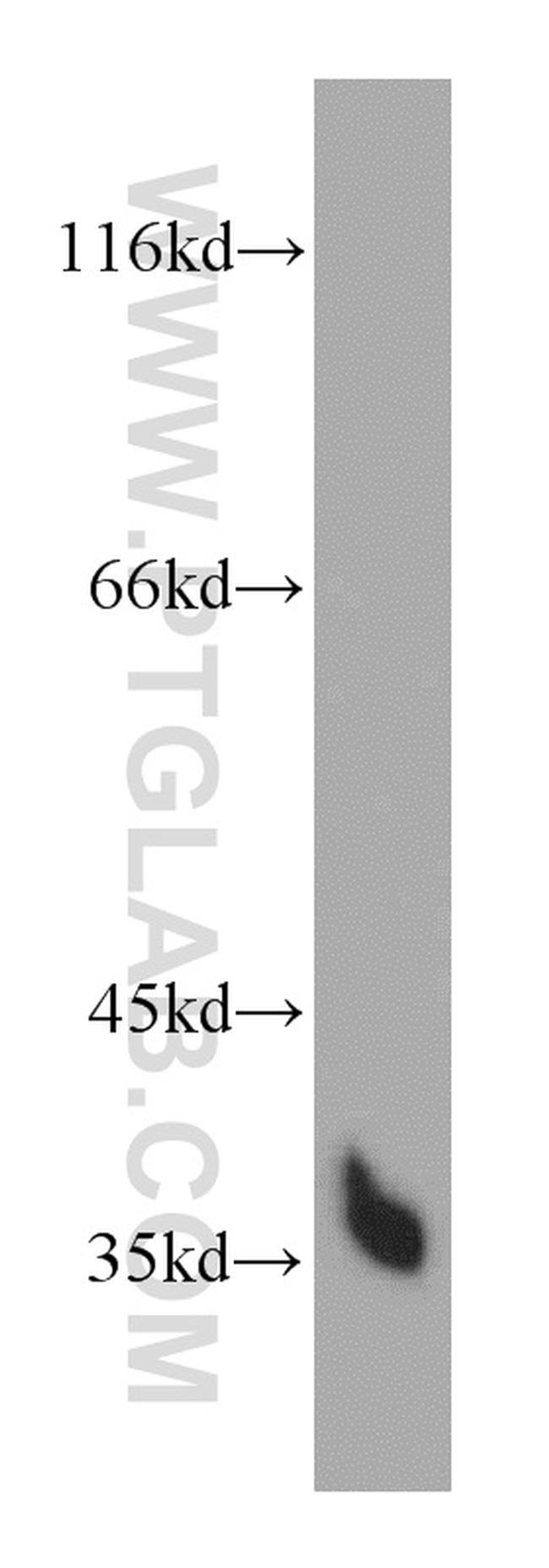 HTRA1 Antibody in Western Blot (WB)