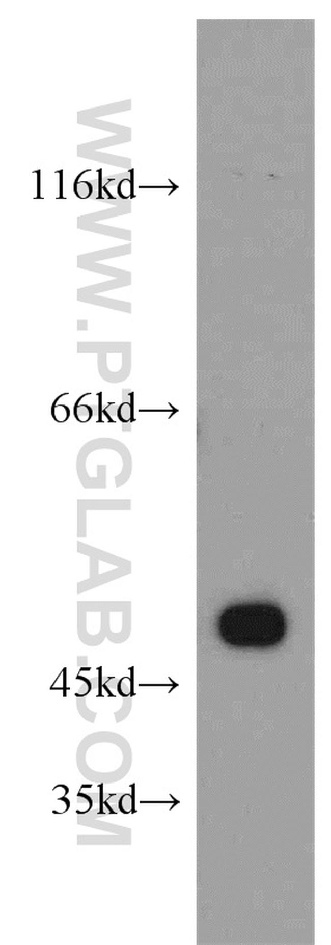 HTRA1 Antibody in Western Blot (WB)