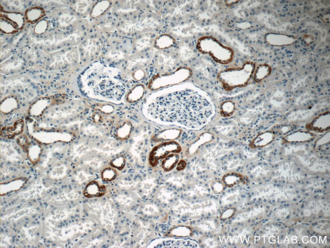 MAF Antibody in Immunohistochemistry (Paraffin) (IHC (P))