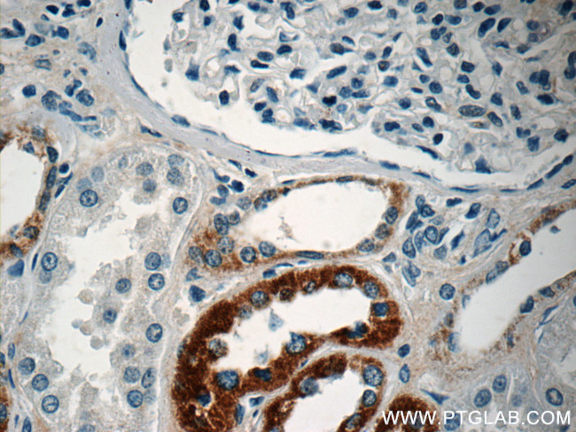 MAF Antibody in Immunohistochemistry (Paraffin) (IHC (P))