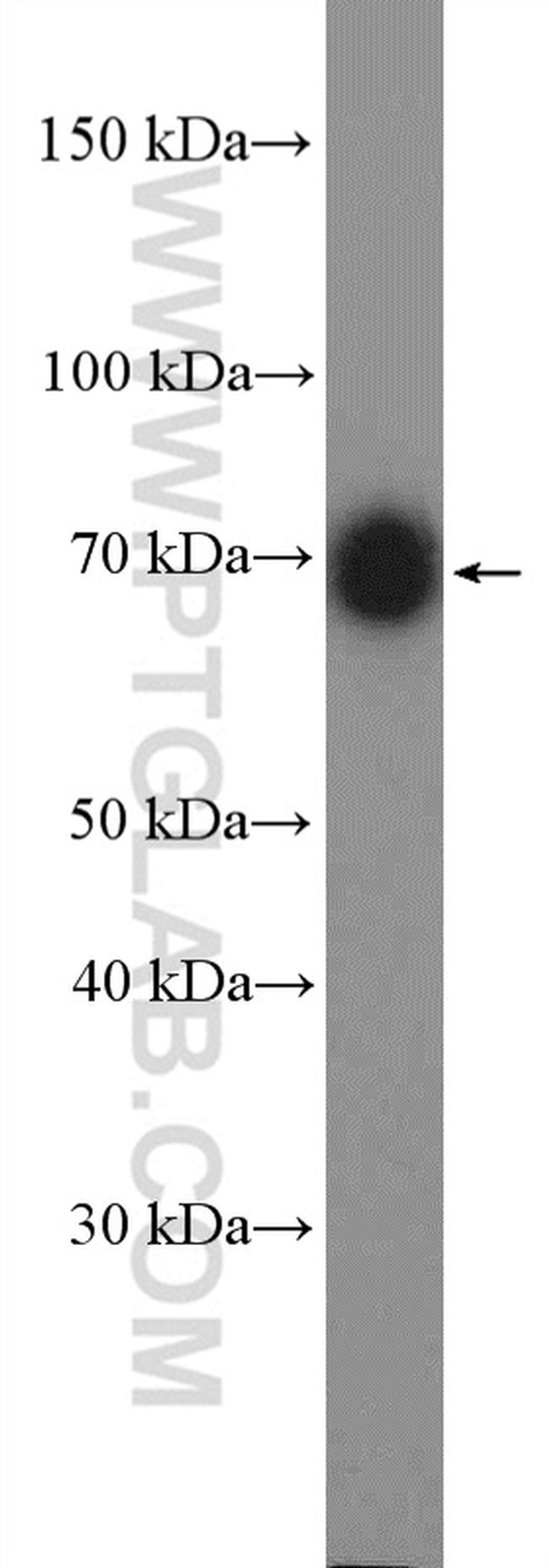 p75NTR Antibody in Western Blot (WB)