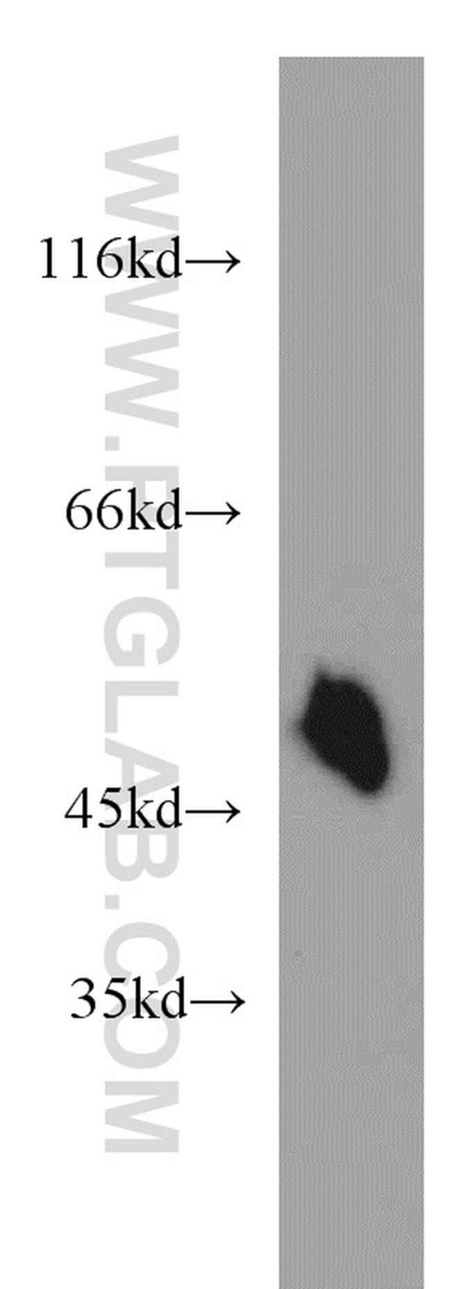 Synaptotagmin-12 Antibody in Western Blot (WB)