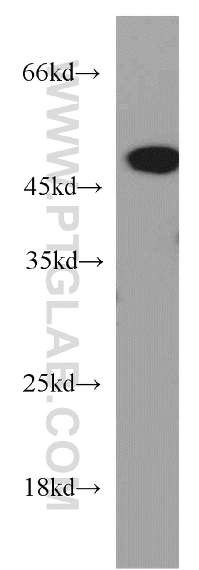 Synaptotagmin-12 Antibody in Western Blot (WB)