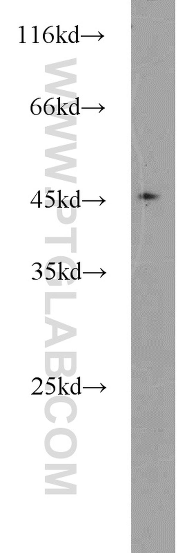 TSC22D4 Antibody in Western Blot (WB)