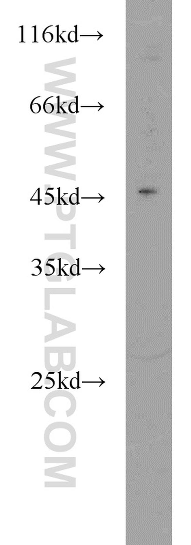 TSC22D4 Antibody in Western Blot (WB)