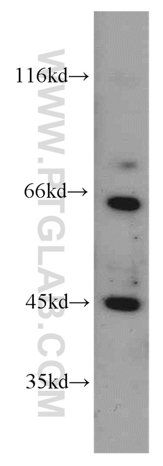 TSC22D4 Antibody in Western Blot (WB)